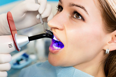 Benecchi Dental Group | Preventative Program, Oral Exams and Periodontal Treatment