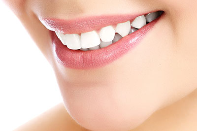 Benecchi Dental Group | Veneers, iTero   Intraoral Scanner and Dentures